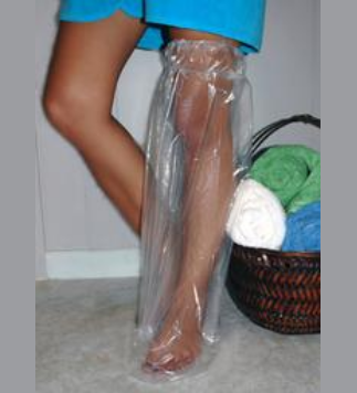 Accelerated Cast Clinic & Limb Preservation Centre | 201-6040 Andrews Way SW, Edmonton, AB T6W 3S9, Canada | Phone: (780) 907-2082