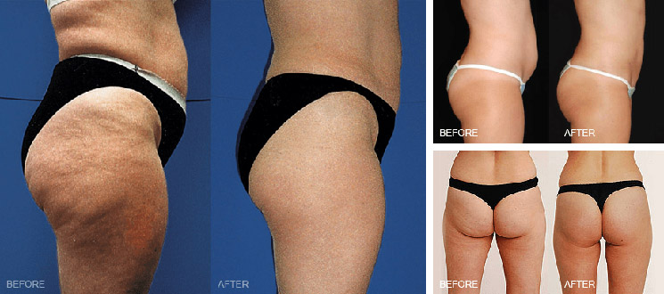 MedSkin Laser & Skincare | 34 Sioux Rd, Sherwood Park, AB T8A 4X1, Canada | Phone: (780) 417-3103