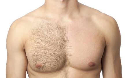 Forever Smooth Electrolysis | 952 Old Almonte Rd, Almonte, ON K0A 1A0, Canada | Phone: (613) 229-4026