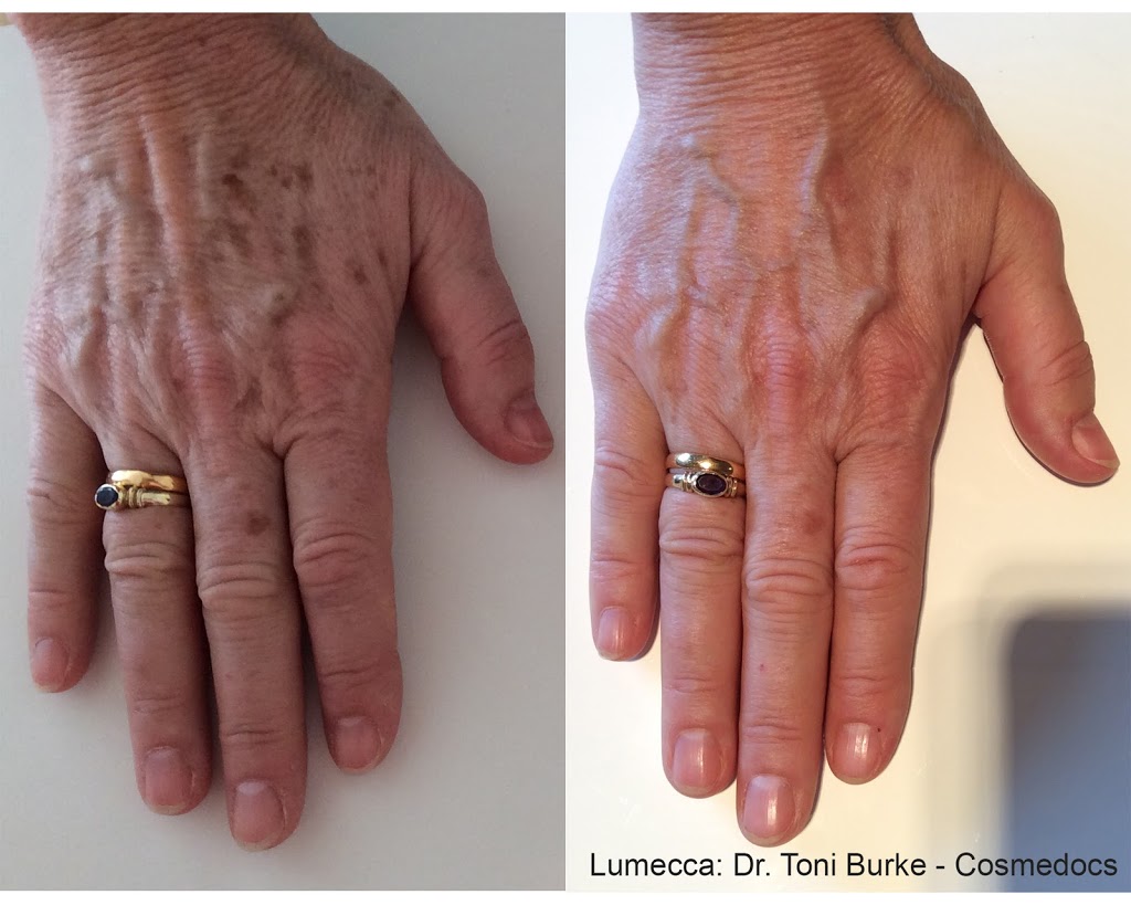 Elan Laser Aesthetics | 2258 Belmont Ct, Burlington, ON L7P 3N3, Canada | Phone: (905) 220-2258