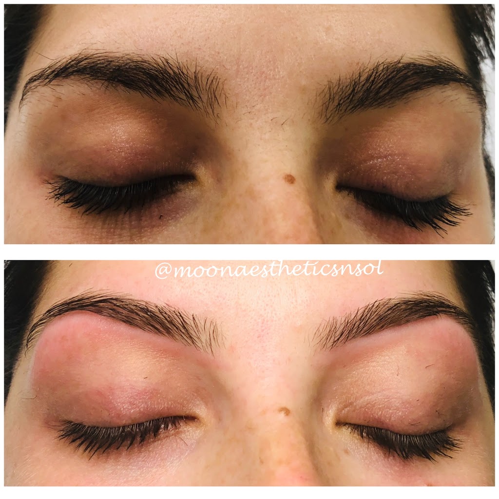 Moon Aesthetics n Solutions | 159 Shephard Ave, Alliston, ON L9R 0J8, Canada | Phone: (705) 718-1836