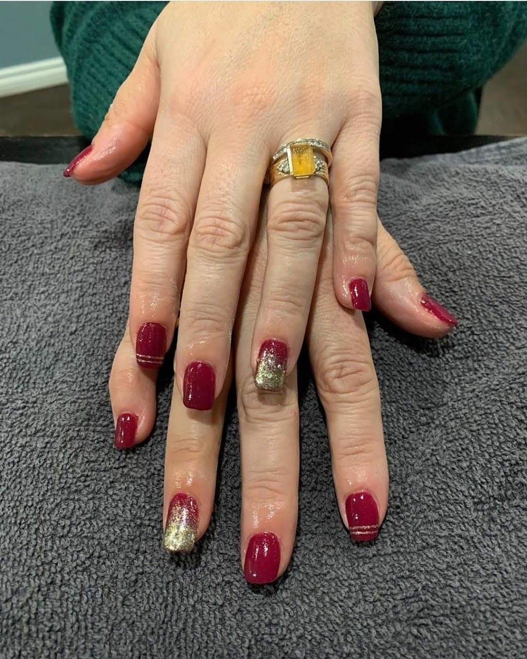 Laser It! Salon & Medical Spa | 1011 Front Rd, Windsor, ON N9J 2A6, Canada | Phone: (519) 734-1565