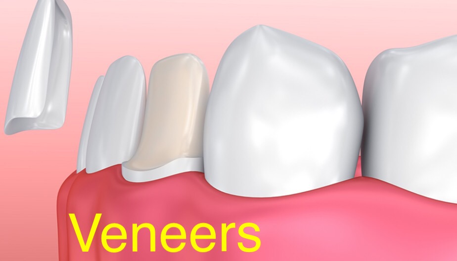Dentistry At Bayview Glen | 8750 Bayview Ave Unit 3, Richmond Hill, ON L4B 4V9, Canada | Phone: (905) 882-0082