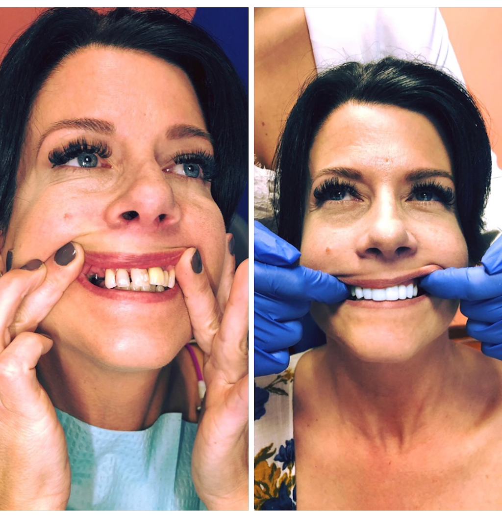 Artistic Dentists of Bellingham at Bellwether Dental | 12 Bellwether Way Ste 114, Bellingham, WA 98225, USA | Phone: (360) 366-8026