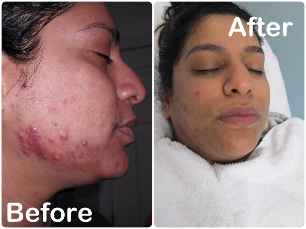 Adam & Eve inc. Total Body Perfection | 8 Glenda Rd, Scarborough, ON M1M 2H4, Canada | Phone: (416) 266-1717