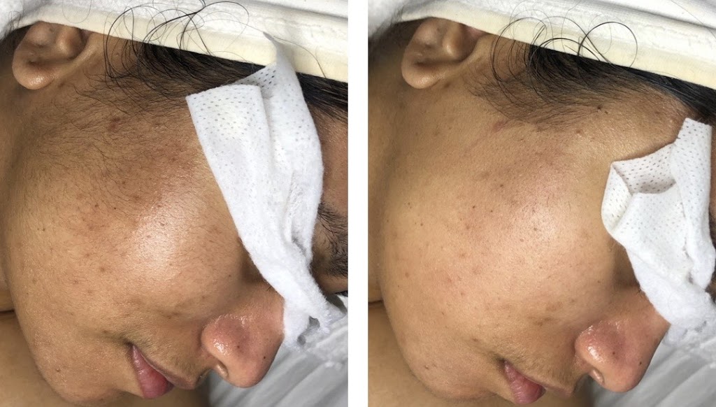 Glow Beauty Bar | 1128 The Queensway, Etobicoke, ON M8Z 1P7, Canada | Phone: (647) 330-6044