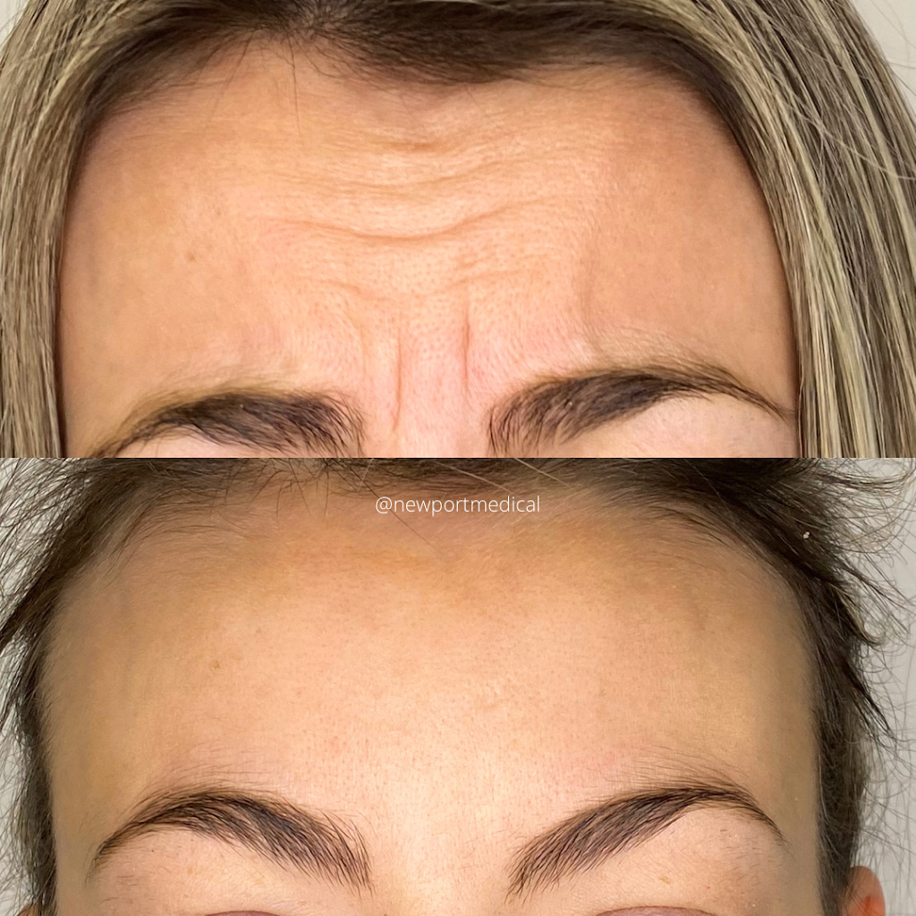 Newport Medical | 1551 Delia Crescent, Orléans, ON K4A 2X9, Canada | Phone: (613) 319-6706