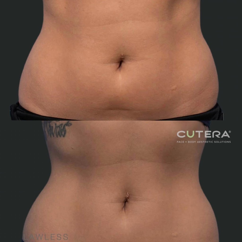The Body Architect | 194 Sherwood Mount Northwest, Calgary, AB T3R 0G5, Canada | Phone: (403) 354-0368