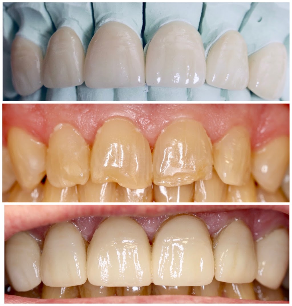 Pinawa Dental Clinic | 34 Vanier Ave, Pinawa, MB R0E 1L0, Canada | Phone: (204) 753-2787