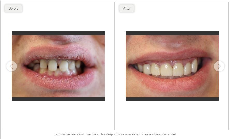 Clearview Market Dental Care | 47 Clearview Market Way #100, Red Deer, AB T4P 0M9, Canada | Phone: (403) 346-7878