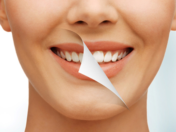 Palermo Village Dental | 2525 Old Bronte Rd #290, Oakville, ON L6M 4J2, Canada | Phone: (905) 815-8888