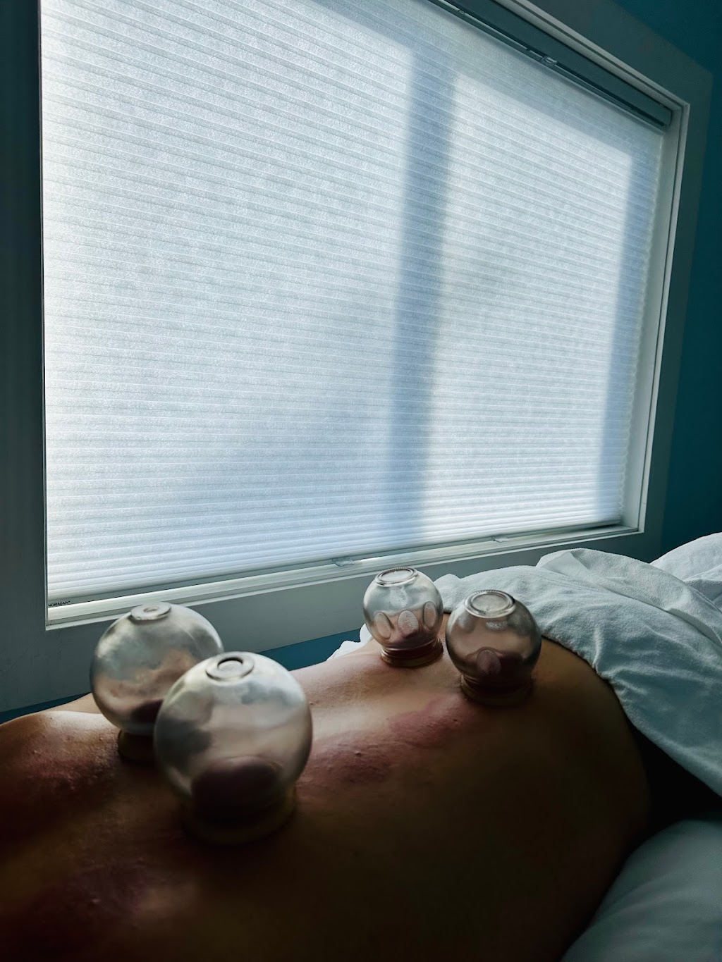 Cumberland Acupuncture | Box 314, 3366 Westwood Rd, Cumberland, BC V0R 1S0, Canada | Phone: (604) 849-4945