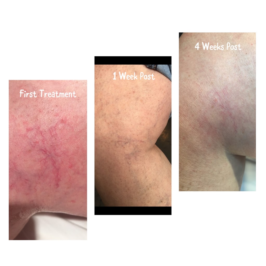 Divine Spectrum Laser Clinic | 9126 122 Ave NW, Edmonton, AB T5B 1B1, Canada | Phone: (587) 372-2463