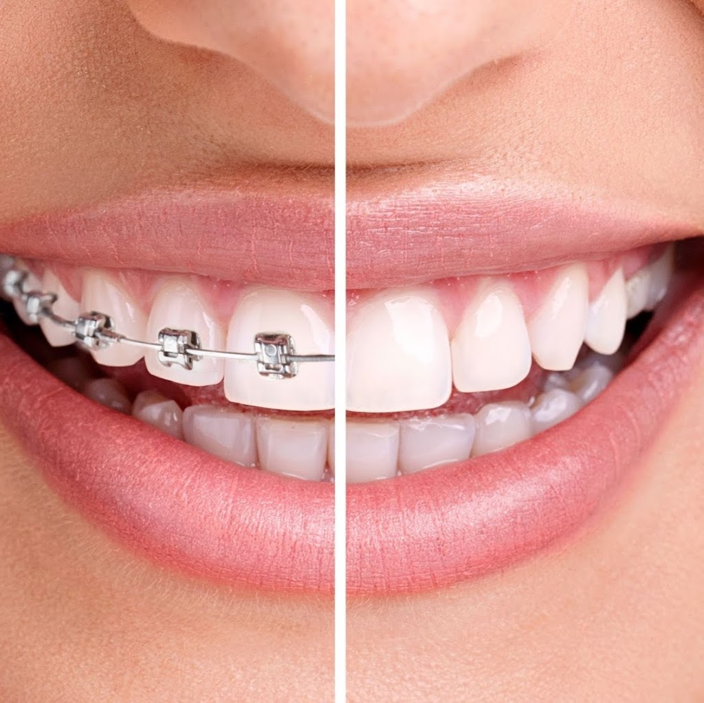 Fallowfield dental | 3350 Fallowfield Rd #6, Nepean, ON K2J 5L1, Canada | Phone: (613) 440-9000