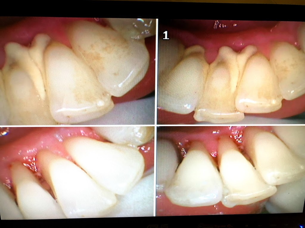 Competitive Dental Hygiene Clinic | 141 King Rd, Richmond Hill, ON L4E 3L7, Canada | Phone: (905) 773-9461