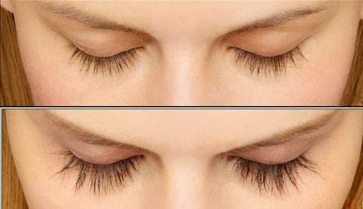 Éternelle Médecine Esthétique | 115 Rue Brock #103, Drummondville, QC J2C 4G8, Canada | Phone: (819) 469-8181