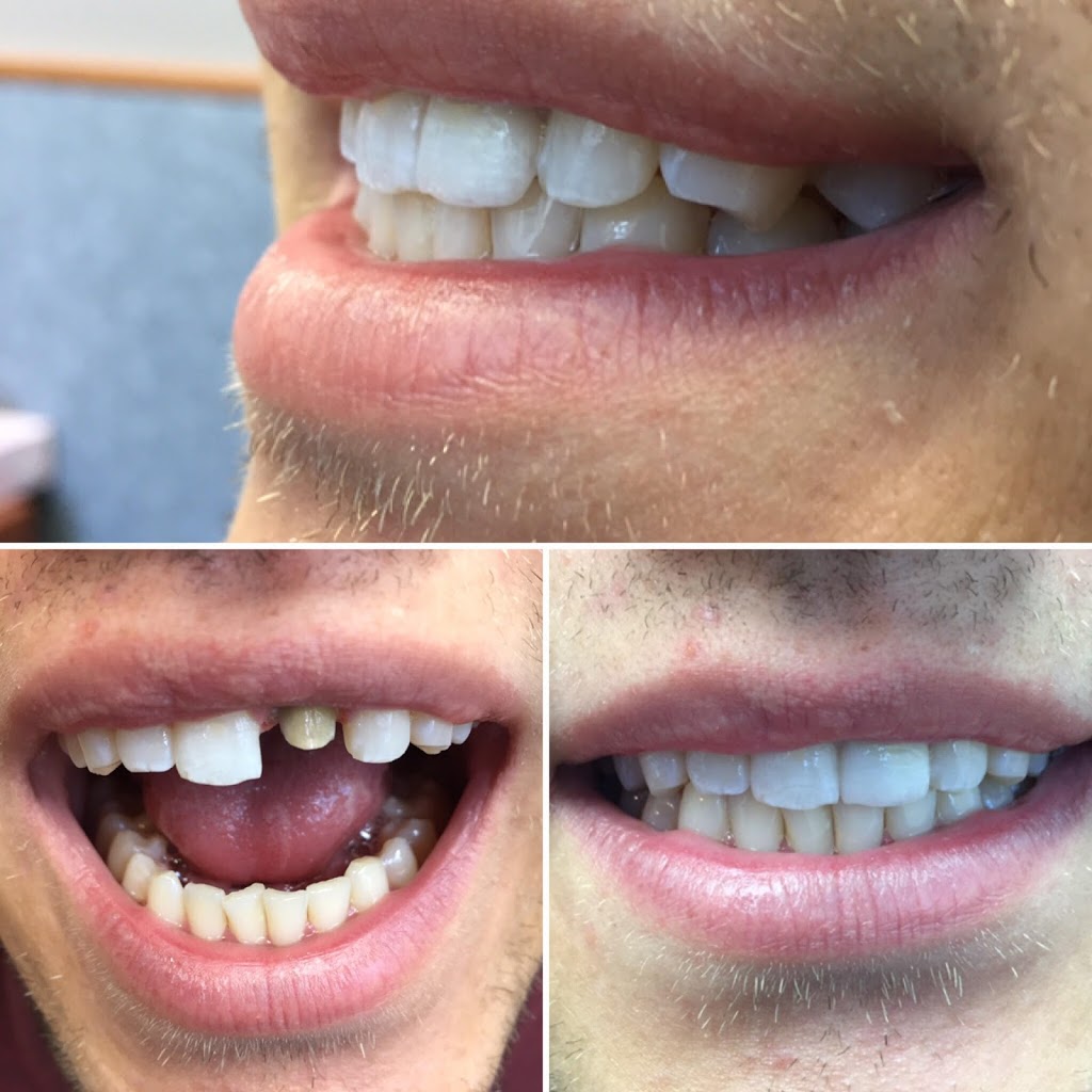 Chois Dental Studio | 1270 King St E, Cambridge, ON N3H 3P8, Canada | Phone: (289) 788-3996