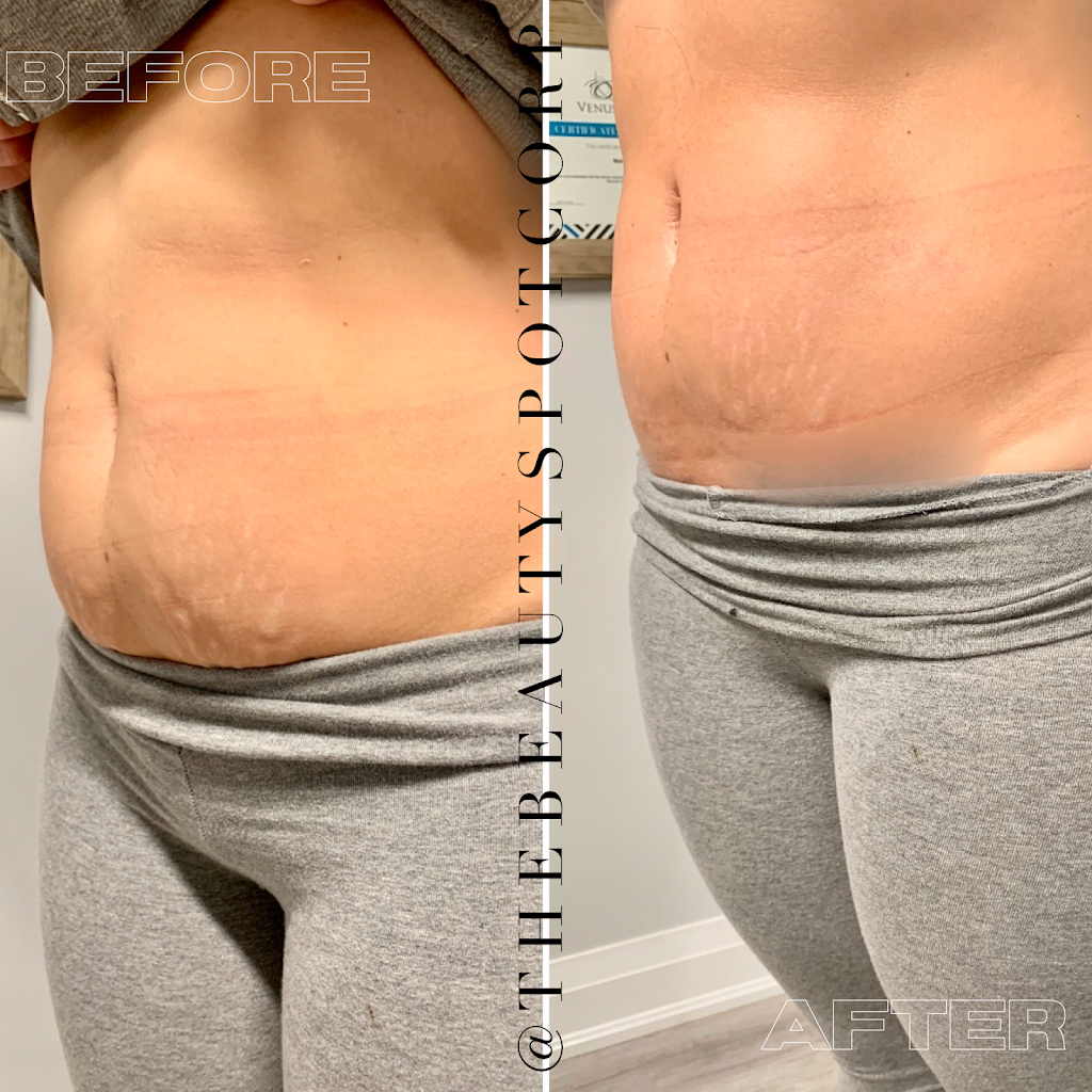 The Beauty Spot Corp. | 397 Kleinburg Smt Wy #1, Kleinburg, ON L4H 4T1, Canada | Phone: (647) 778-7356