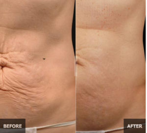 Flawless Beauty & Health Spa | 161 Colborne St W, Brantford, ON N3T 1L3, Canada | Phone: (226) 920-8244