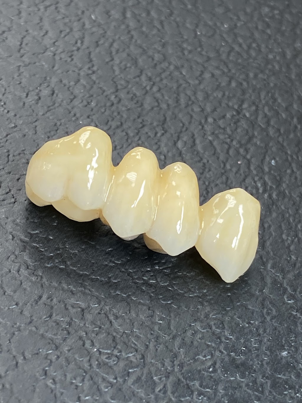 Labworks Dental Services | 10160 Ainsworth Crescent, Richmond, BC V7A 3V4, Canada | Phone: (604) 916-1875