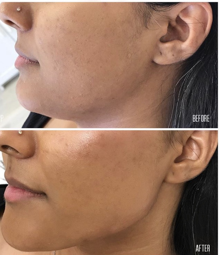Body Perfection | 36 Tynevale Dr, Etobicoke, ON M9R 2B5, Canada | Phone: (647) 523-4526