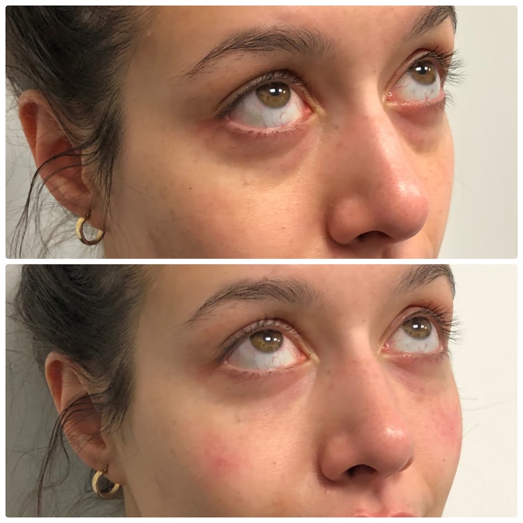 S.M.L.L Skin Solutions | 1092 Islington Ave Unit #201, Etobicoke, ON M8Z 4R9, Canada | Phone: (416) 417-2516
