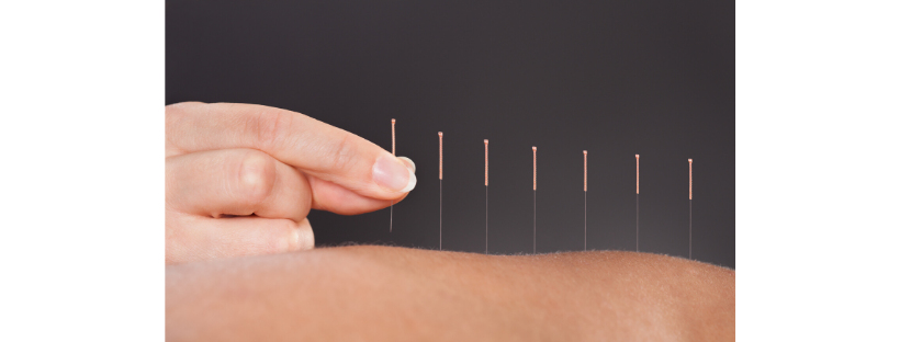 Dr. Jenelle Timmers DTCM, R.Ac | 151 Copperpond Blvd SE, Calgary, AB T2Z 0Z7, Canada | Phone: (403) 474-3238