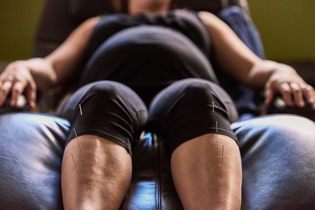 Oaktree Orléans - Chiropractor, Acupuncture & Chinese Medicine | 2054 St Joseph Blvd, Orléans, ON K1C 1E6, Canada | Phone: (613) 424-4315