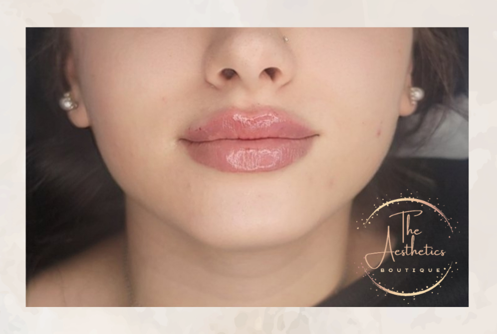 The Aesthetics Boutique | 64 Viking Dr, Binbrook, ON L0R 1C0, Canada | Phone: (289) 921-8240