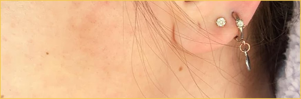 Awaken HydraFacial Windsor | 3926 Concession Rd 6, Windsor, ON N9G 2H4, Canada | Phone: (226) 777-6645