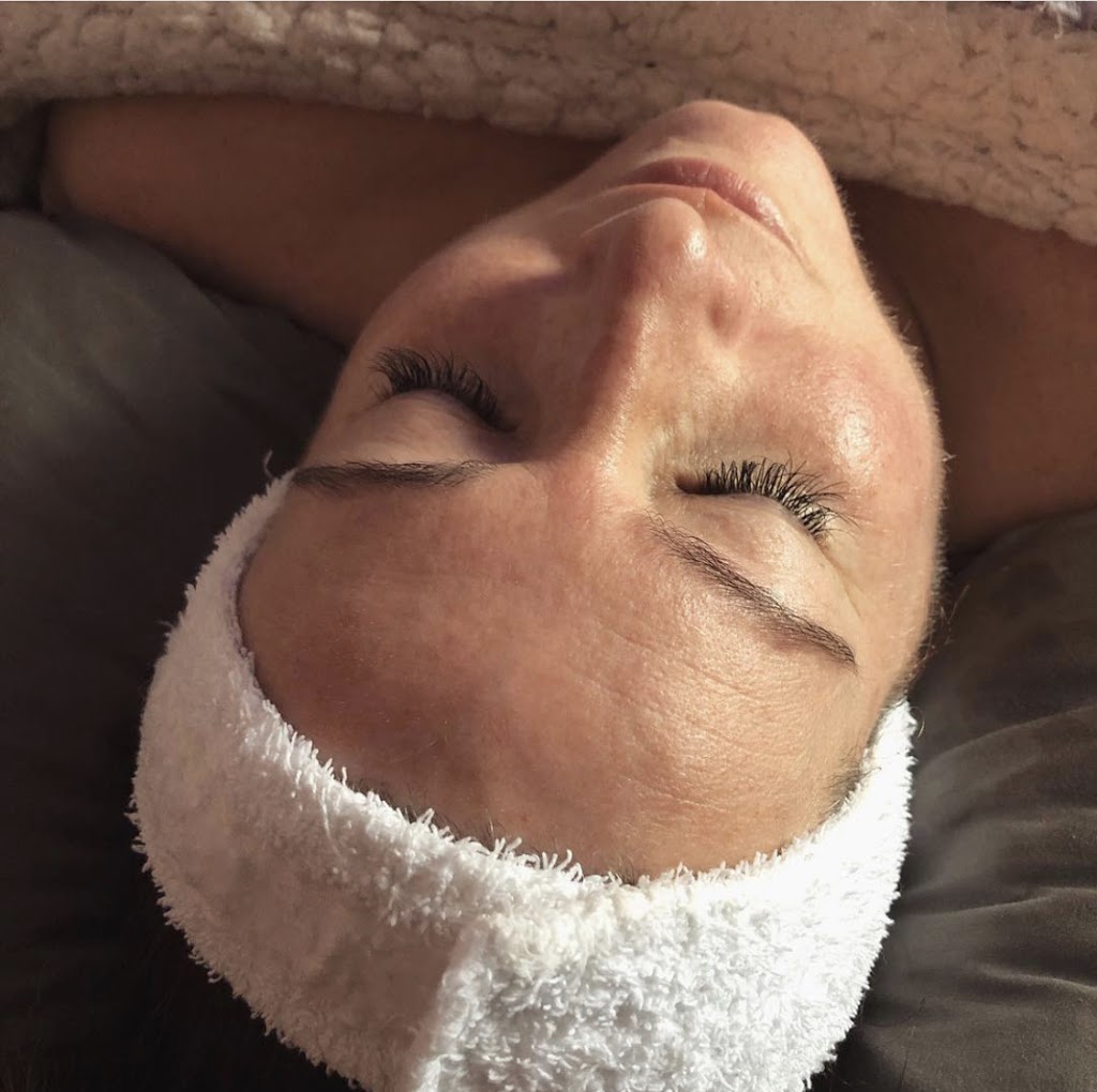 Skinsooolush Medi Spa | 278 Queen St S 2nd Floor, Bolton, ON L7E 4Z5, Canada | Phone: (647) 527-7546
