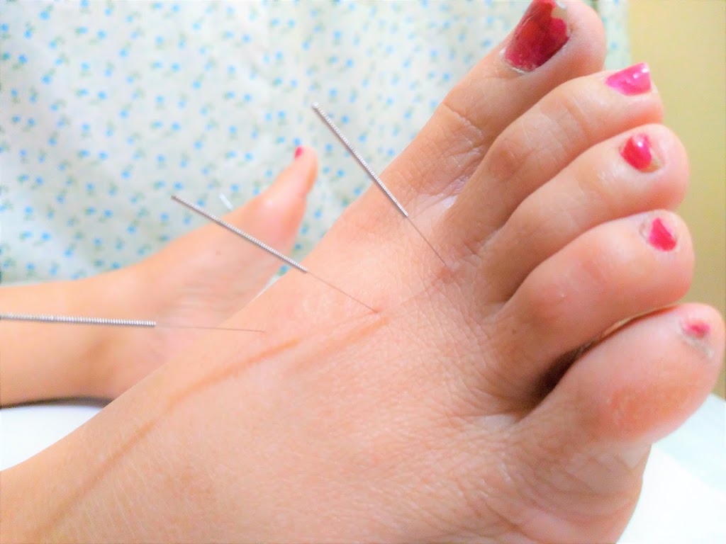 green nature acupuncture | 15159 81 Ave, Surrey, BC V3S 7B9, Canada | Phone: (778) 317-2366