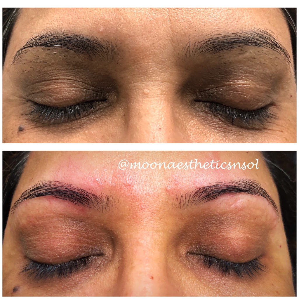 Moon Aesthetics n Solutions | 159 Shephard Ave, Alliston, ON L9R 0J8, Canada | Phone: (705) 718-1836