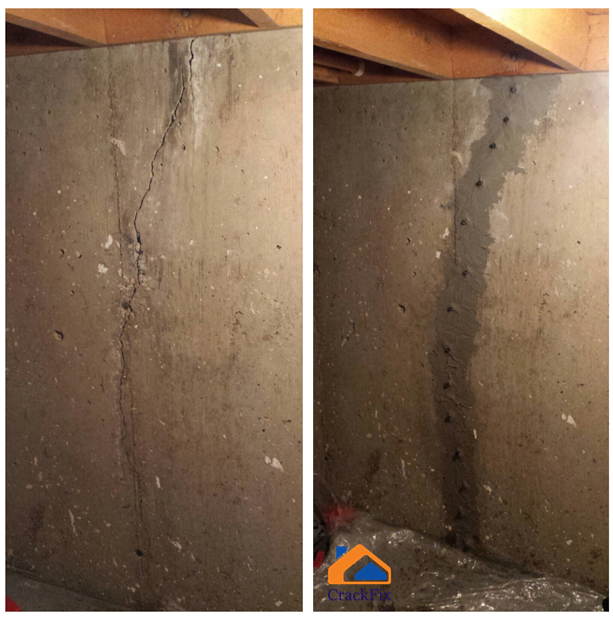 CrackFix Foundation repair | 10724 60 Ave NW, Edmonton, AB T6H 1H4, Canada | Phone: (587) 712-1980