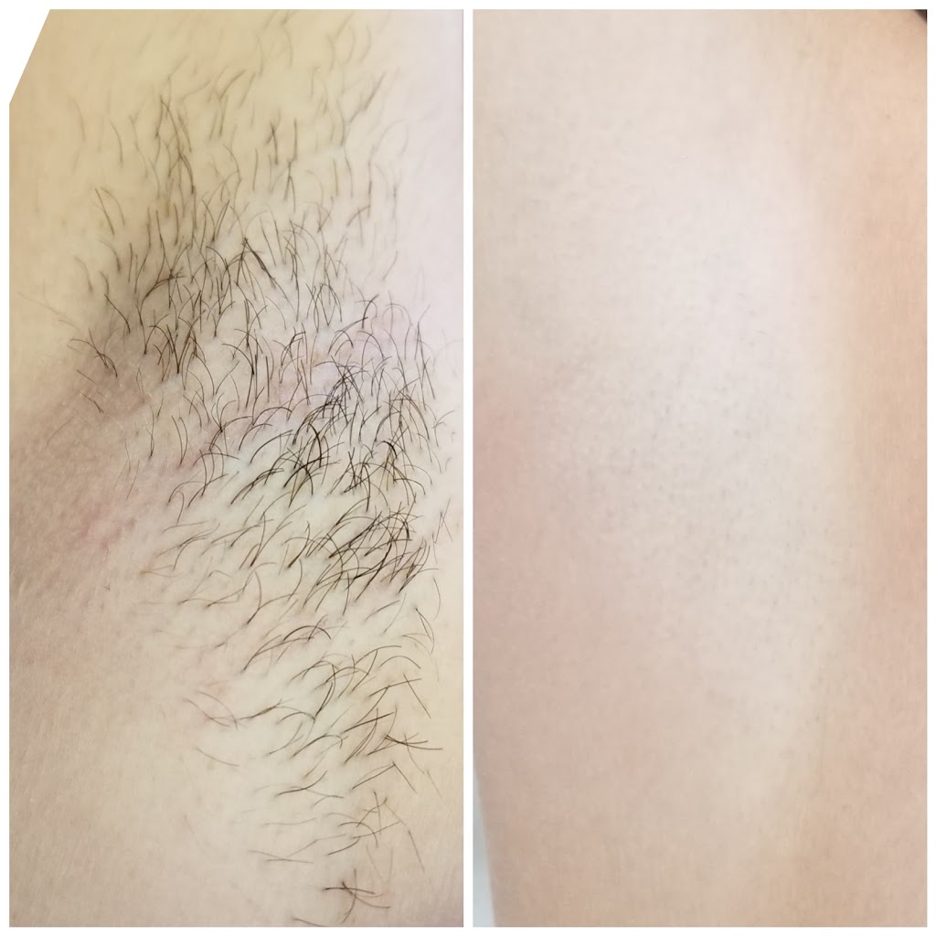 Skin Essentials Laser Clinic | 58 Cathedral High St, Markham, ON L6C 0P3, Canada | Phone: (416) 843-7458