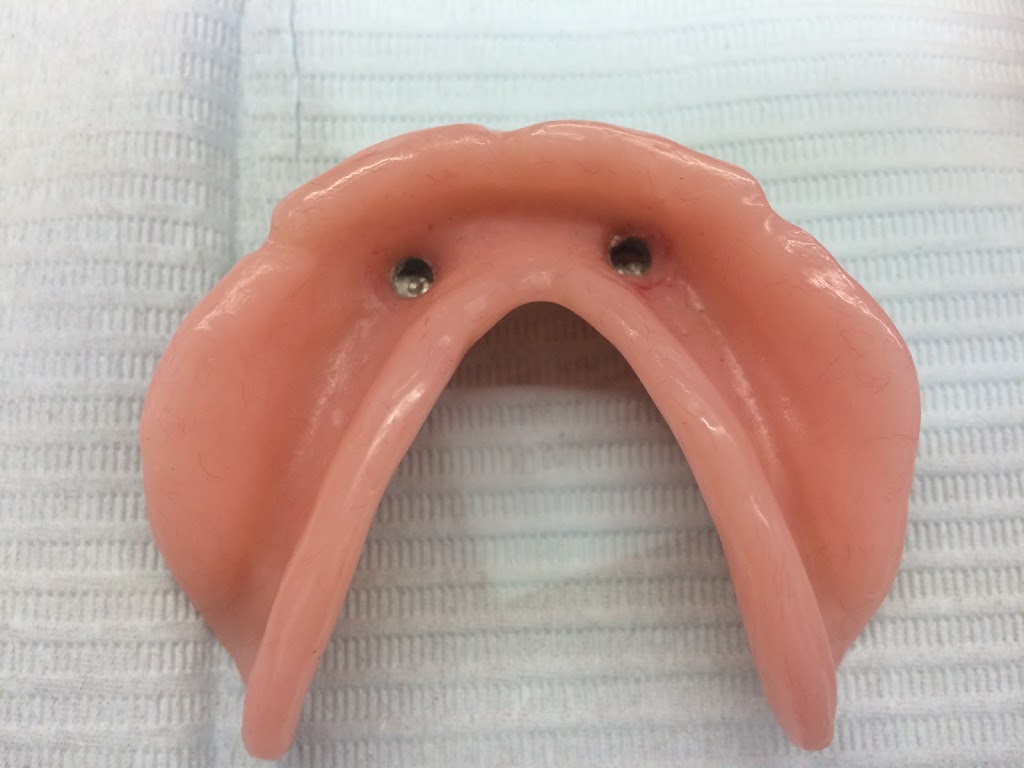 Dans Denture Clinic | 172 Manning Crossing NW, Edmonton, AB T5A 5A1, Canada | Phone: (780) 244-3200