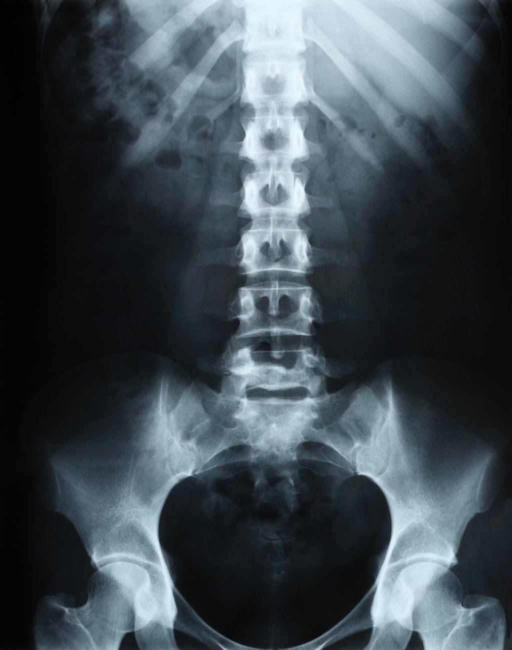 Life Chiropractic Centre | 8-2501 Guelph Line North, Burlington, ON L7M 2A3, Canada | Phone: (905) 335-5433