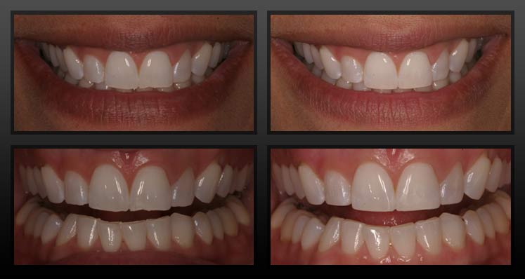 Tooth Care Centre | 6061 York Regional Rd 7, Markham, ON L3P 3B2, Canada | Phone: (905) 554-3555