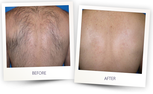 Dermace Advanced Skin Care Clinic | 6633 Hwy 7 suite 303, Markham, ON L3P 7P2, Canada | Phone: (905) 554-8144