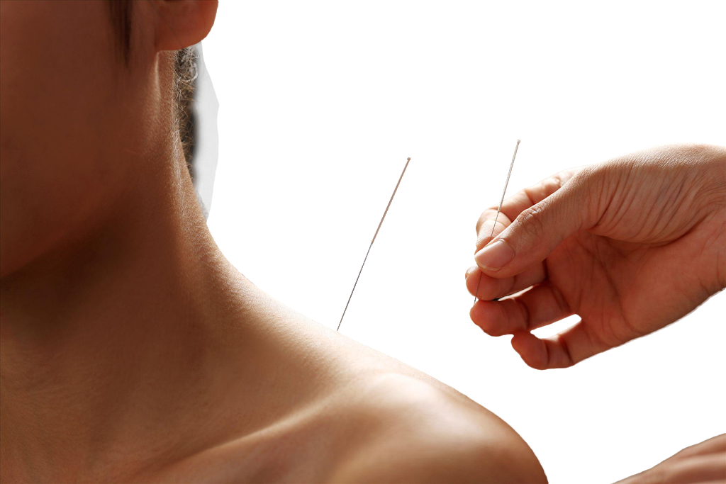Kiai Acupuncture Clinic | JCCC (Japanese Canadian Cultural Centre, 6 Garamond Ct Suite 240, North York, ON M3C 1Z5, Canada | Phone: (647) 707-9530