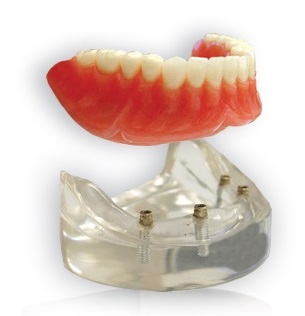 Clinique De Denturologie Gabrielle Lambert | 1460 Boulevard Rome, Brossard, QC J4W 2T4, Canada | Phone: (450) 486-6624