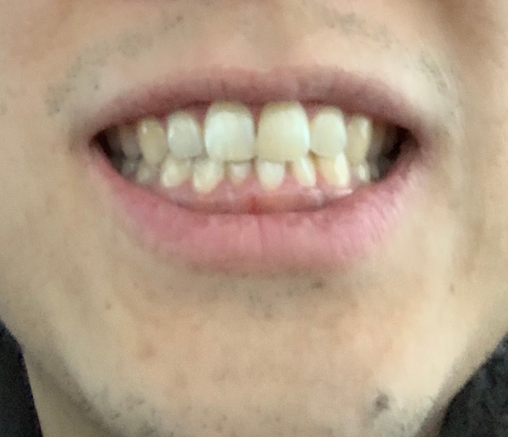 Green Apple Dental Fleetwood | 8501 162 St, Surrey, BC V4N 1B2, Canada | Phone: (604) 597-1311