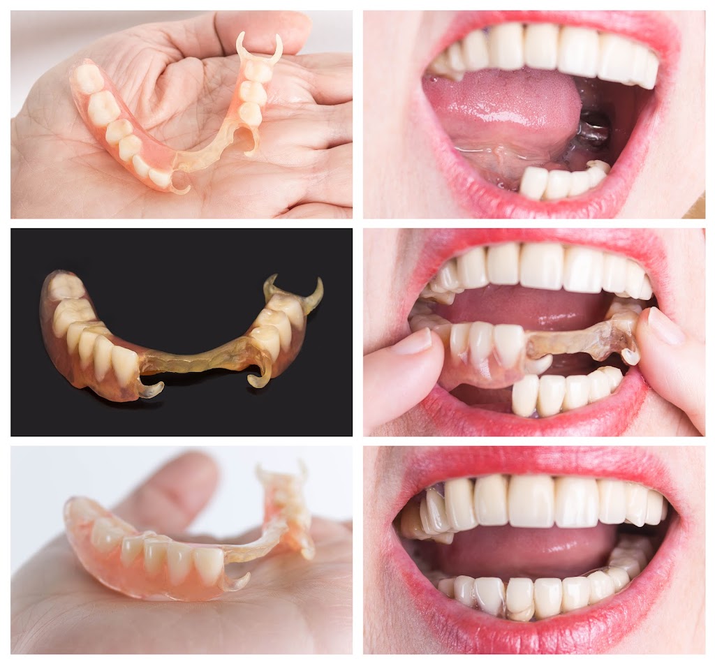 Modern Denture Clinic | 11 Bronte Rd unit 30, Oakville, ON L6L 0E1, Canada | Phone: (905) 902-6254
