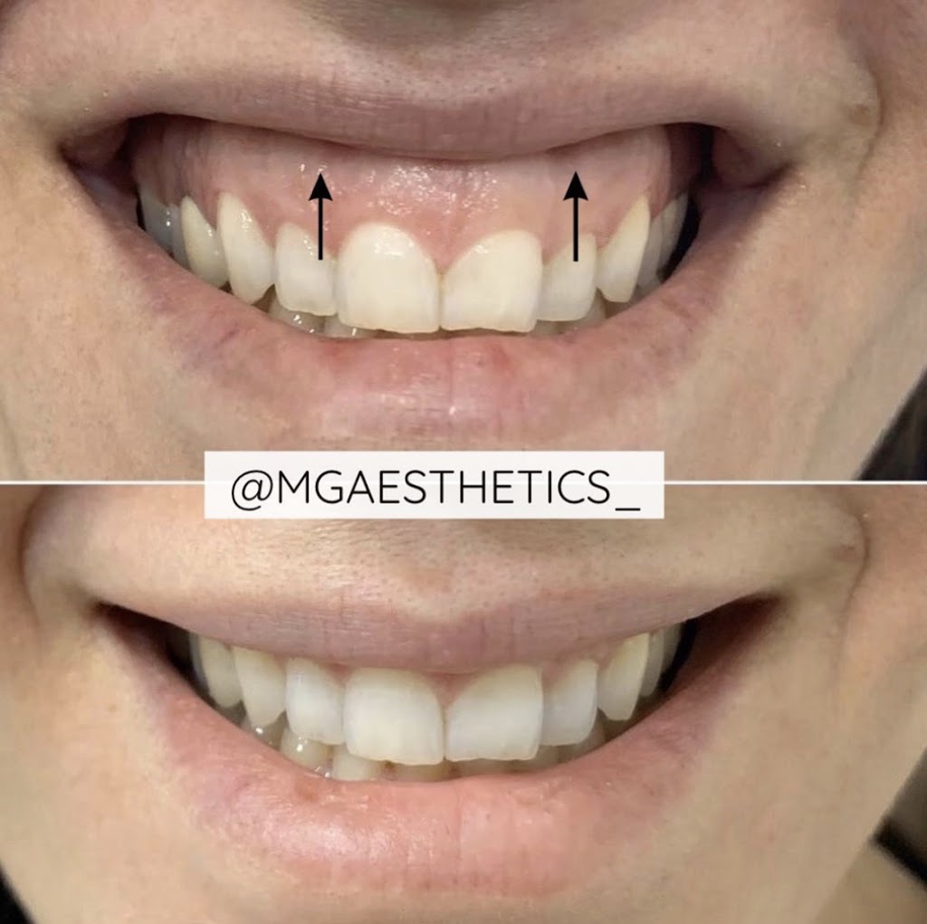 MG AESTHETICS | 10395 Weston Rd, Woodbridge, ON L4H 3T4, Canada | Phone: (289) 380-7774