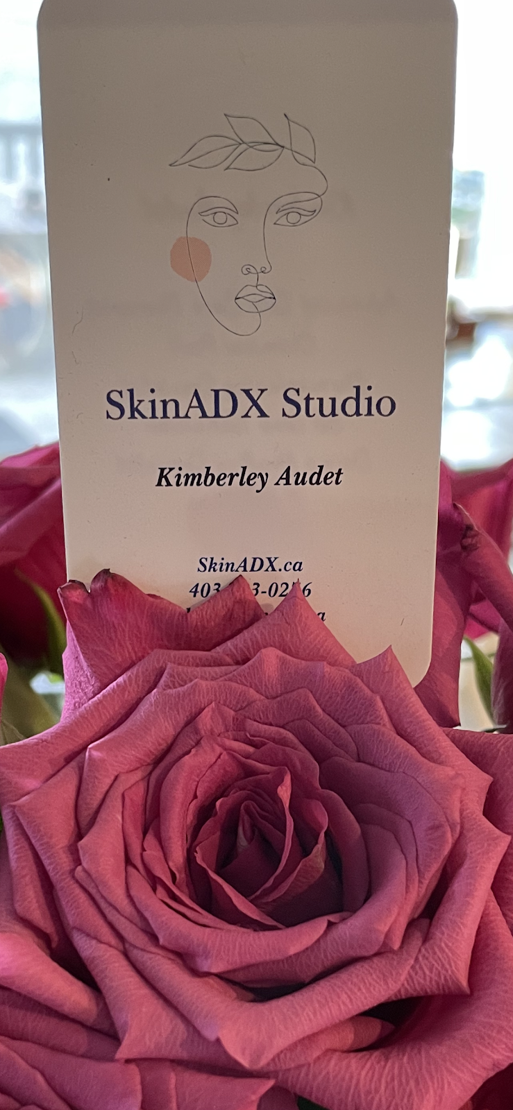 SkinADX Studio | Tuscany Dr NW, Calgary, AB T3L 2N8, Canada | Phone: (403) 483-0276