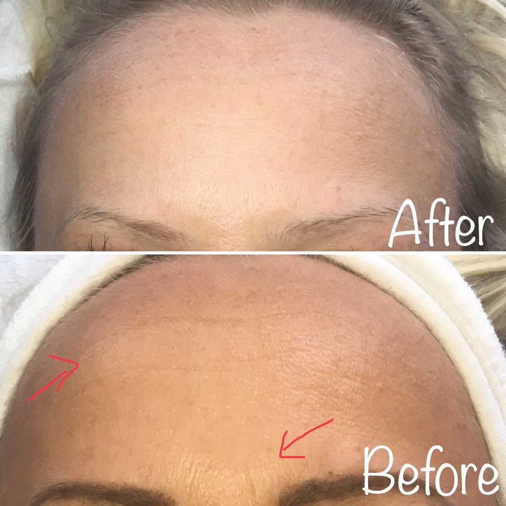 Skin 2 Envy Laser Med Spa | 3 Cox Crescent, Brampton, ON L6X 3H1, Canada | Phone: (416) 892-6792