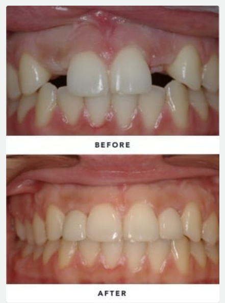 Smile Dental Implant Center - White Rock Dentists & Dental Implants | 1959 152 St, Surrey, BC V4A 9E3, Canada | Phone: (604) 531-3344