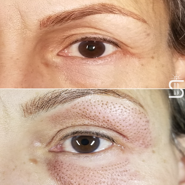 Skindigo Beauty | 7225 Winterburn Rd NW, Edmonton, AB T5T 4K2, Canada | Phone: (587) 501-0991