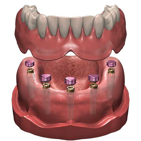 Denturologiste Boisbriand | 574 Bd du Curé-Labelle Bureau 203, Blainville, QC J7P 2H8, Canada | Phone: (514) 506-4983