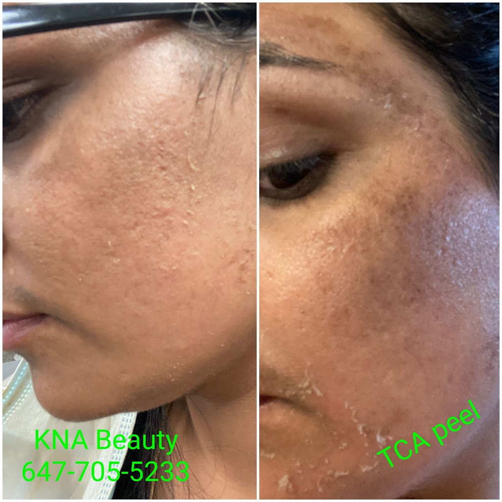 KNA beauty studio | 19 Erlesmere Ave, Brampton, ON L6W 2T4, Canada | Phone: (647) 705-5233